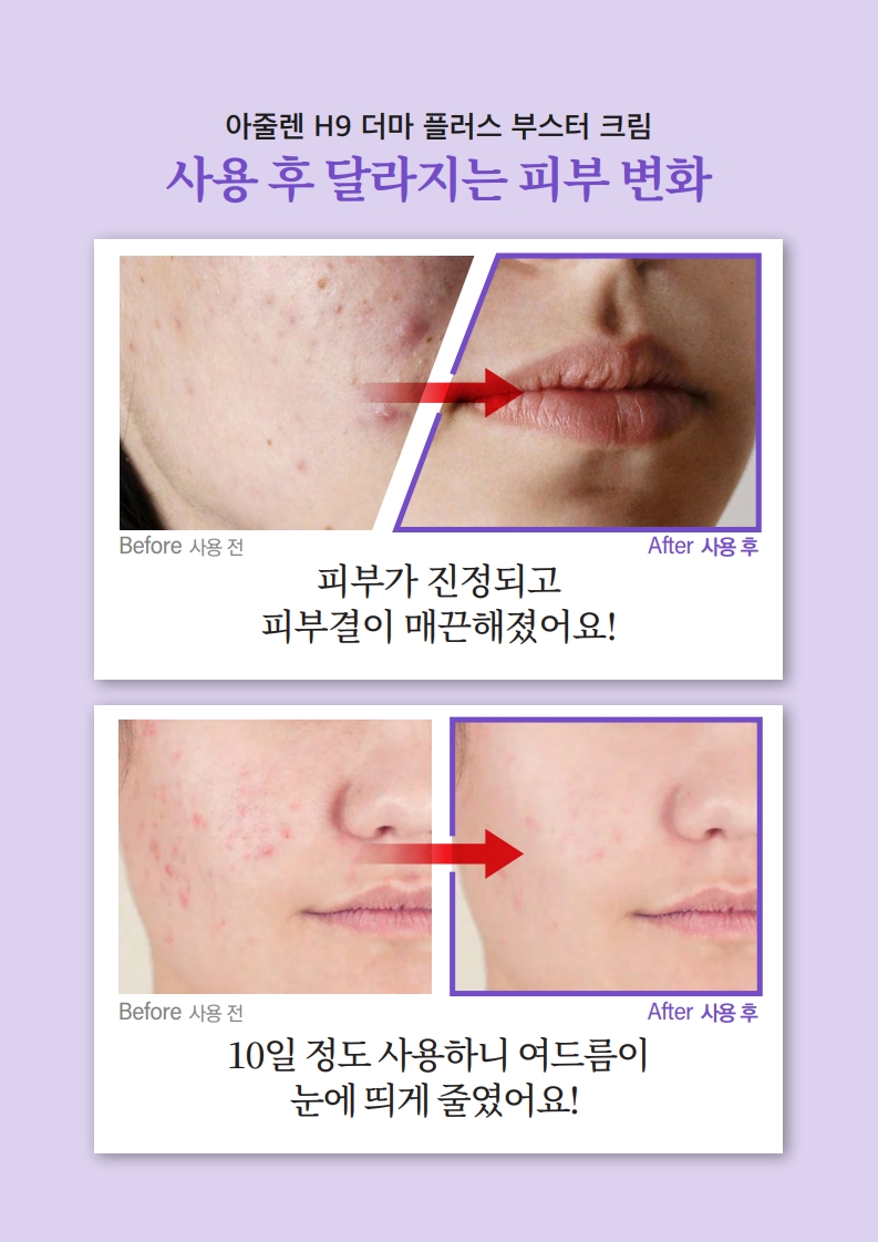 TalkFile_리피다 아줄렌H9더마플러스부스터크림 50ml(한글)_A4.pdf_5.jpg